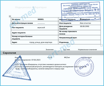 Купить тест на антитела к вирусу кори Купить справку тест на антитела к вирусу кори в Люберцах официально